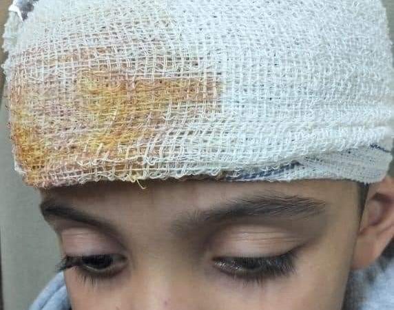 كلب مسعور يهاجم مواطنين في منطقة التحسينية